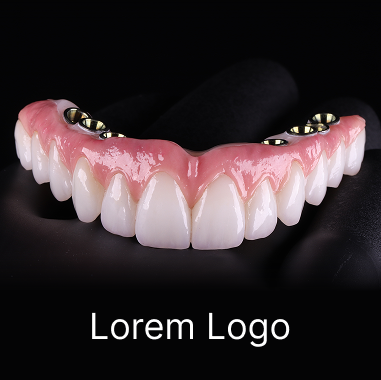 Hybrid Implant Bridge